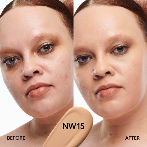 A woman shows clear skin improvement with makeup on one side and bare skin on the other. Text reads NW15, before and after.