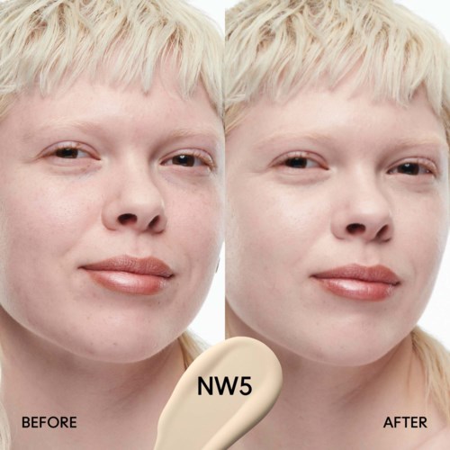 Before and after photos showing skin improvement with NW5 product. Clear, smooth skin appearance. Woman with blonde hair.
