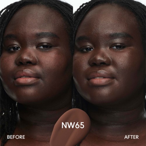 Before and after photos showing skin improvement after a treatment. Text in the center says 'NW65'.