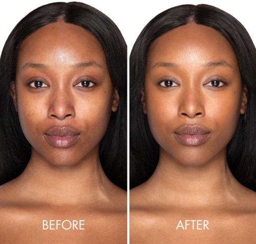 A woman shows clear skin improvement with makeup, looking confident before and after a beauty treatment.