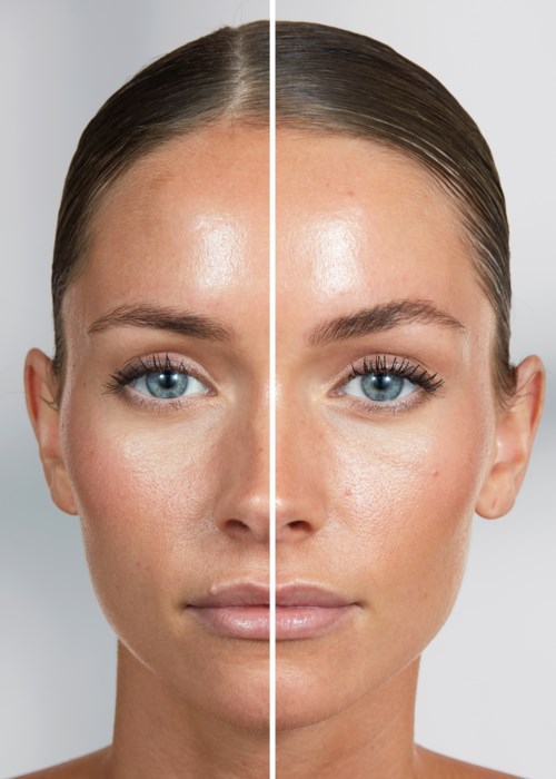 En kvinnas ansikte med klar, slät hud, visat före och efter hudvårds- eller makeupanvändning.