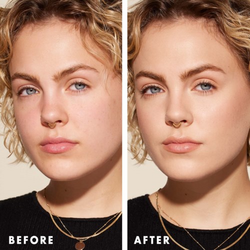 A woman with curly blonde hair, wearing a black top and gold jewelry, shows a before and after skin transformation.