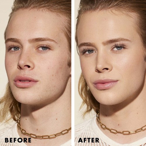 Side-by-side photos show before and after skin smoothing and blemish removal on a young woman's face.