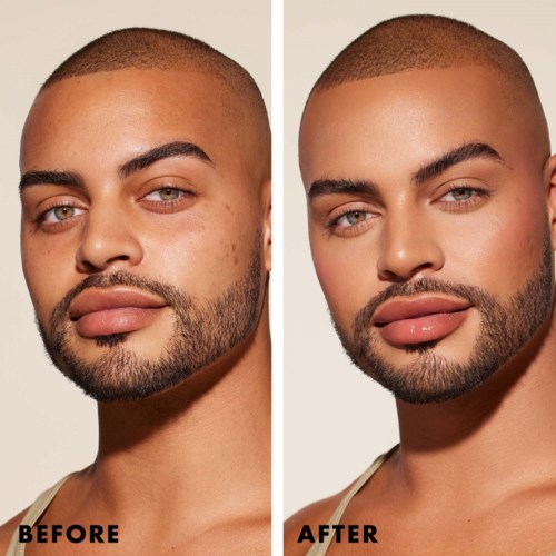 A man with a beard and short hair shown before and after cosmetic enhancements to skin and lips.