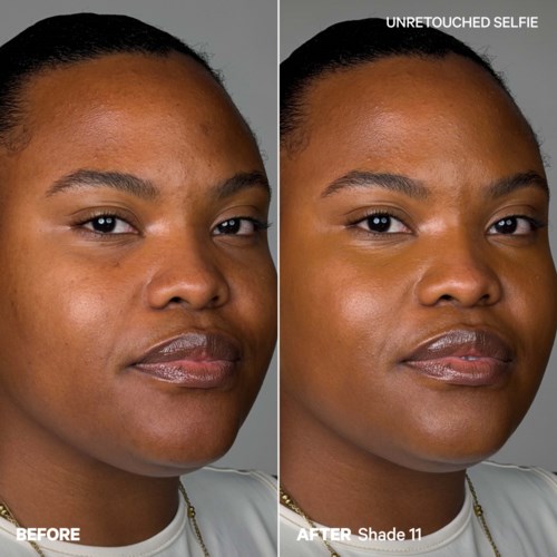Comparison of a woman's face before and after applying a skincare product, showing clearer skin and even tone.