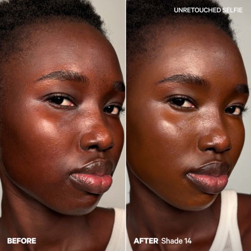Comparison of skin before and after using a product, showing clearer, smoother skin after treatment.