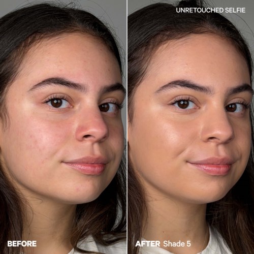 Side-by-side images show skin improvement after using a skincare product, from blemished to clear, glowing skin.