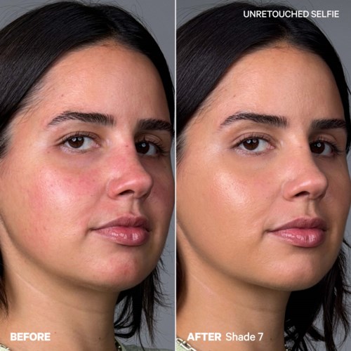 Side-by-side photos of woman showing skin improvement after using a product, labeled 'Before' and 'After Shade 7' with clear skin.