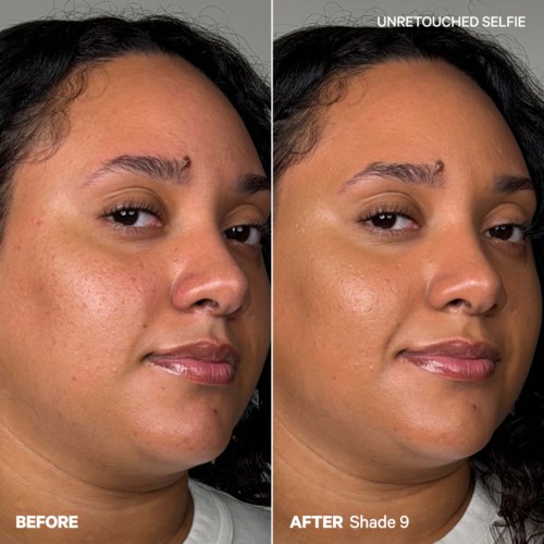 Side-by-side images show a woman's face before and after skincare, with improved skin texture and tone after treatment.