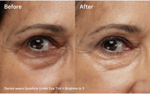 Close-up of eye area showing before and after skin improvement with brightening product.