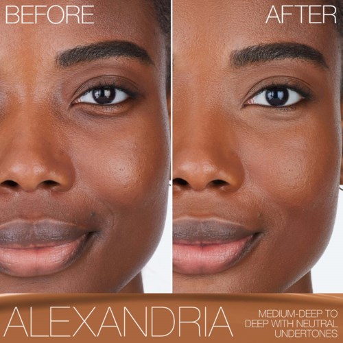 Skin looks clearer and more even after a skincare treatment or makeup application. The person has a slight smile and smooth skin.