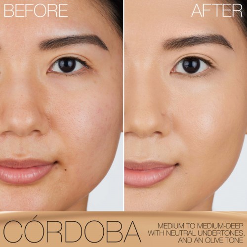 Skin clearer and smoother after treatment, reducing freckles, redness, and dark spots.