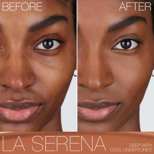 A woman’s face shows before and after skincare, with smoother, clearer skin in the after image. The words "LA SERENA" are at the bottom.