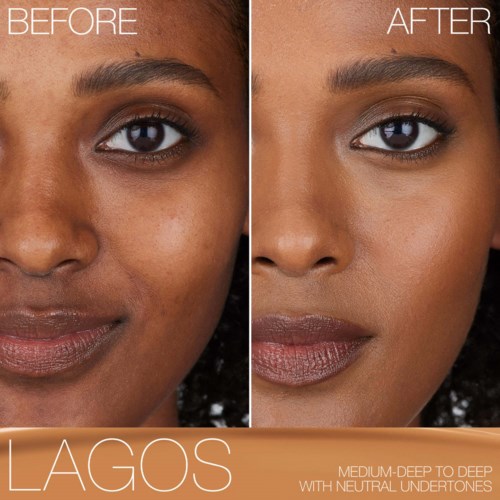 A woman shows clear skin improvement before and after skincare, highlighting smoother, brighter face in after photo.
