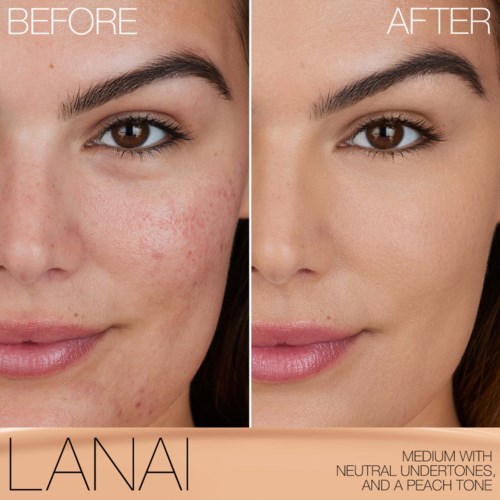 A side-by-side comparison shows clear skin improvement after skincare treatment.
