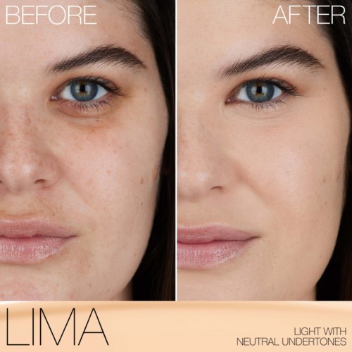 A side-by-side photo showing clear skin before and after a treatment or product by LIMA.