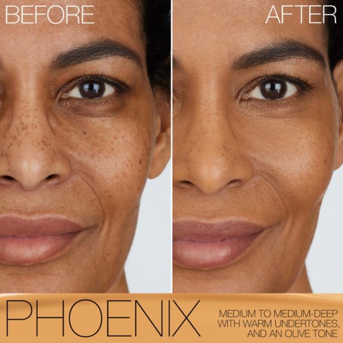Before and after images showing clear skin improvement and a brighter complexion.