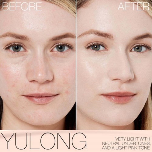 A side-by-side comparison shows a woman's face before and after skin treatment. Complexion clearer and more even in the after.