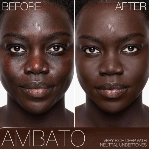 A side-by-side comparison showing dark skin before and after using skincare to clear acne and brighten skin.