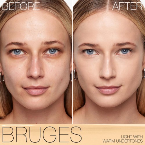 A woman with clear skin in a before and after skincare treatment, showing improvement in skin smoothness and tone.