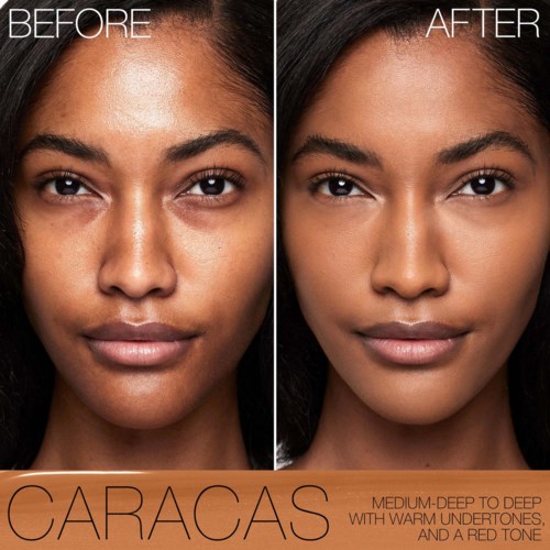 A woman's face shows before and after skincare, with clearer, glowing skin on the right. Caribbean text and description of skin tone.