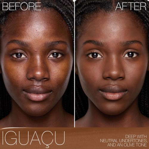 A side-by-side of a woman before and after skincare, showing clearer, smoother skin in the after photo.
