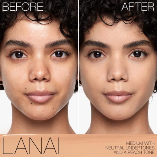 A woman's face shows before and after skin treatment, with clearer, smoother skin and fewer spots.