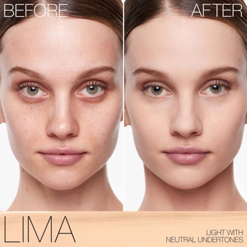 Before and after photos show clearer skin and fewer freckles after treatment.