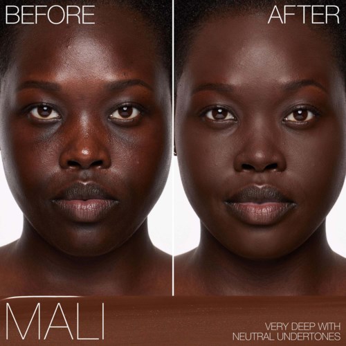 A before and after photo showing clearer, brighter skin after skin treatment. The person has a calm expression.