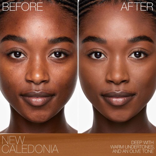 A woman shows clear skin improvement, with smoother complexion and brighter expression in the after photo.