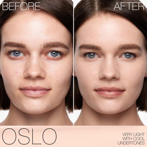 A side-by-side comparison of a woman's face showing clear skin after using skincare products.