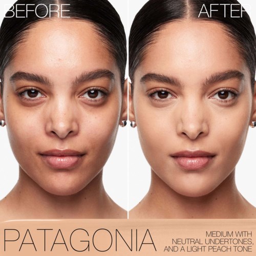 A woman's face before and after skin treatment, showing clearer skin and a more even tone.