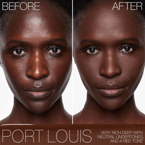 A side-by-side comparison shows a woman's face before and after skin treatment, with smoother and brighter skin in the after image.