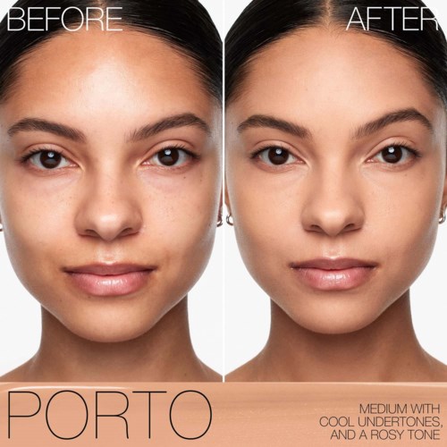 Side-by-side images showing a woman's face before and after skin treatment, with smoother skin and fewer blemishes.