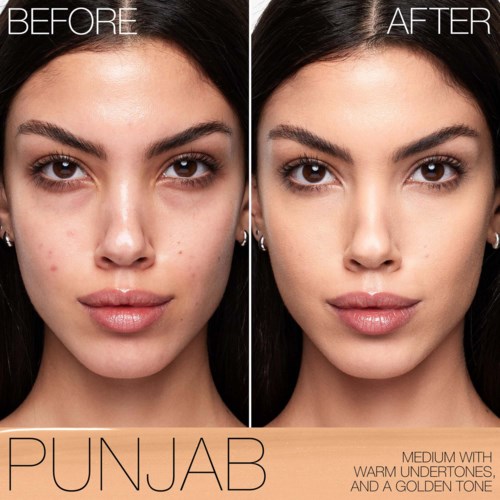 Before and after photos showing clearer, smoother skin with fewer pimples and blemishes.