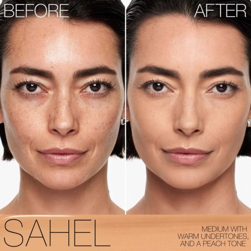 The woman shows clearer skin and fewer spots in the after image compared to the before image.