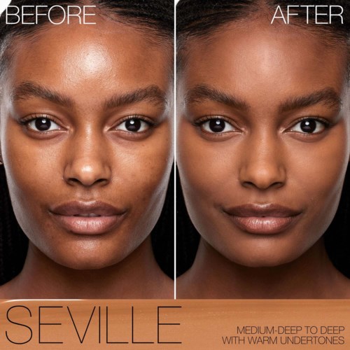 A face showing before and after skin treatment, looking smoother and clearer in the after image, with text at bottom mentioning Sevile.