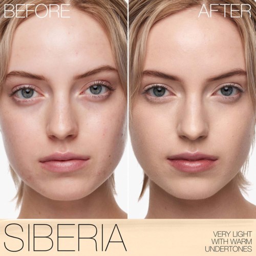 A woman with clearer skin in the after photo compared to the before, showing improved complexion and reduced blemishes.