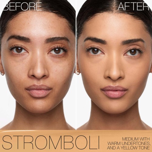 A side-by-side comparison of a woman's face before and after skin treatment, showing clearer, smoother skin.
