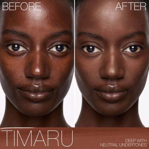 A face shows before and after skin treatment, with smoother, clearer skin in the second image. Titled Timaru.