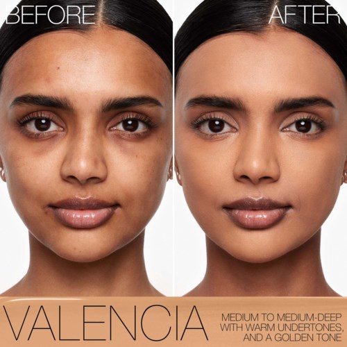 A woman with clearer skin and brighter face in the after photo compared to before.