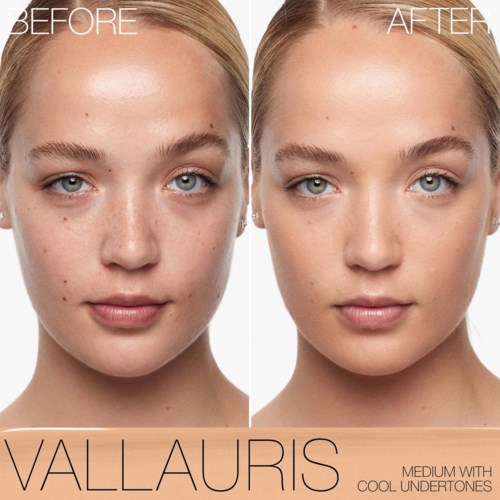 A young woman with clear skin shows before and after results of skincare treatment. The after image has fewer blemishes.