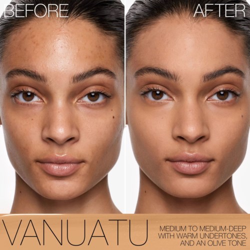 A woman's face shows significant skin improvement, clear and smooth in the after photo, compared to the before with spots.