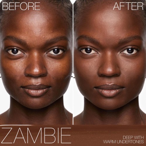 Side-by-side images showing before and after skin treatment, improving complexion and reducing dark spots.