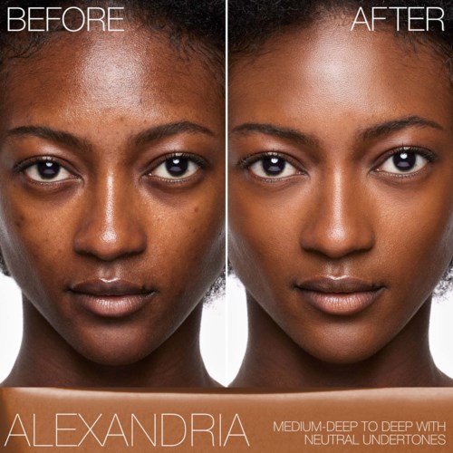Side-by-side images showing a woman's face before and after skincare treatment for clearer, smoother skin.