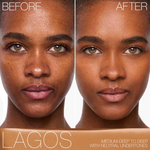 Before and after photos showing a woman's face with clearer skin after using a skincare product from Lagos.