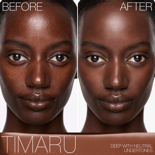 Comparison of a woman's face before and after skincare treatment, showing smoother, clearer skin with a radiant glow.