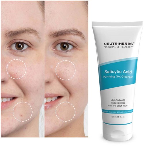 Vorher und nachher Hautverbesserung mit Salicylsäure Gelreiniger für klare, glatte Haut. Enthält Produktbild.