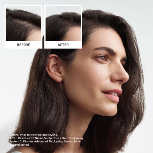 Vrouw met lang, donker haar glimlacht. Inset toont haar voor en na gebruik van een verdikkingsserum.