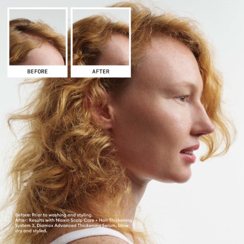 Een vrouw met krullend rood haar voor en na haarbehandeling, met dikker haar en gezondere hoofdhuid.